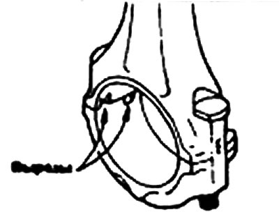 2. Замените шатун при наличии…
