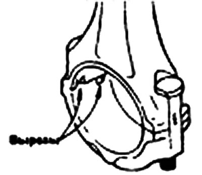 Момент затяжки: Гайки крепления крышки…