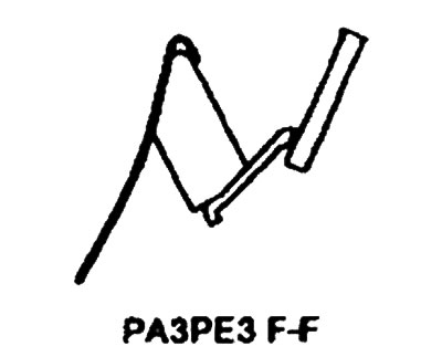Windshield — Removal, Inspection and…
